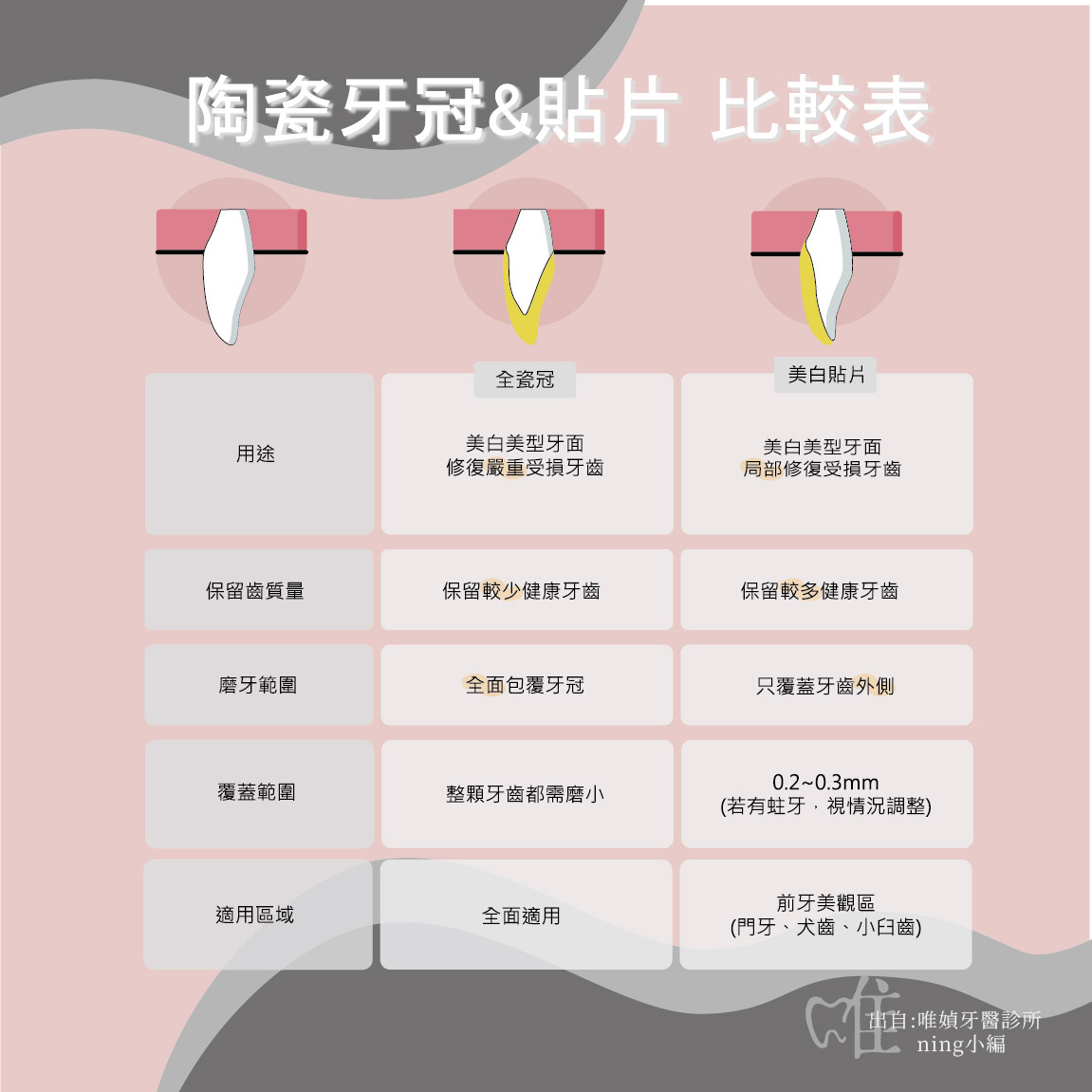 全瓷及假牙的比較