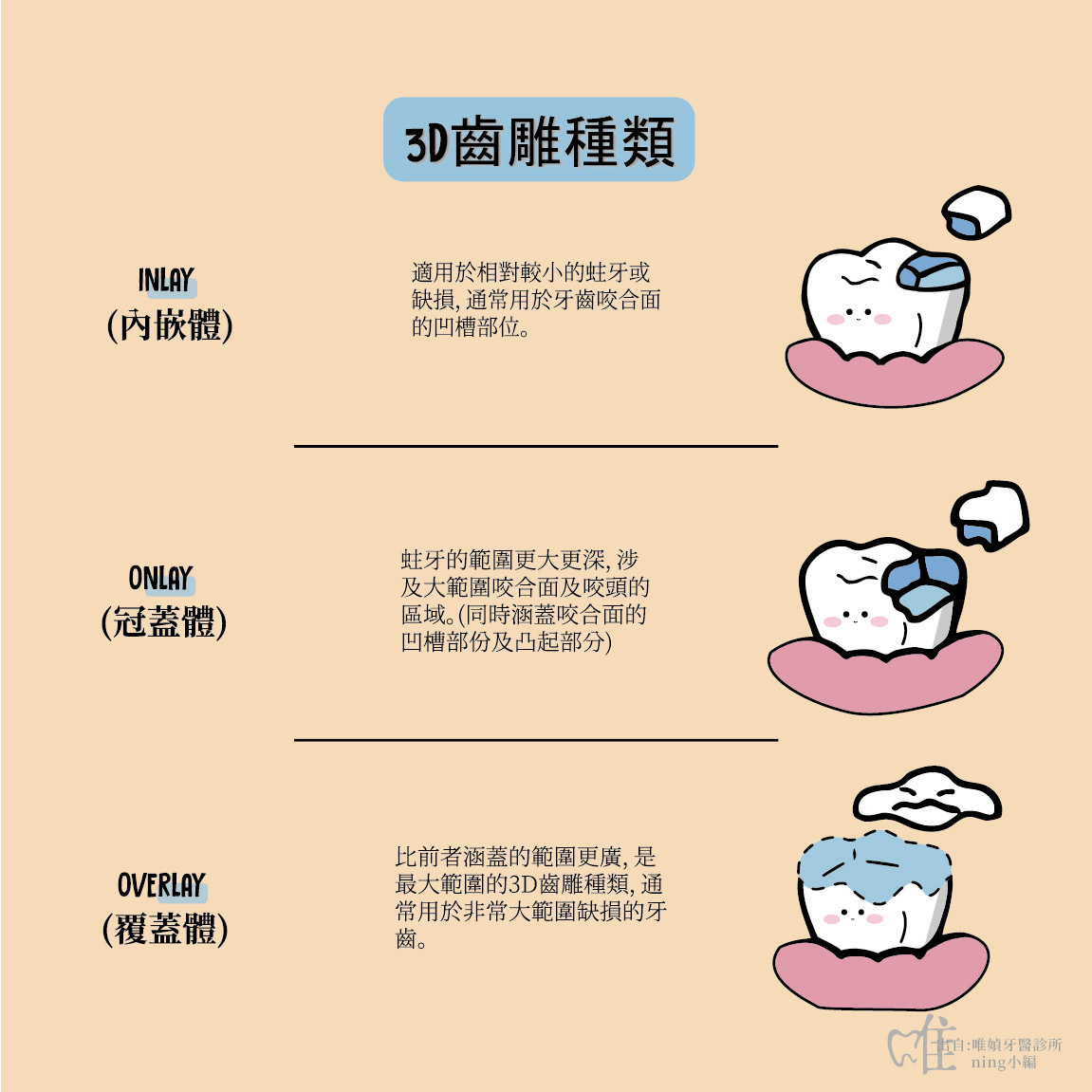 3D齒雕種類與區別